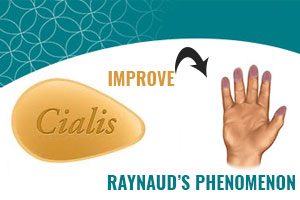 Is Cialis The Answer To Raynaud’s Phenomenon?