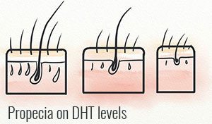 Does Finasteride Have An Effect On The DHT Levels Of Men With Genetic Hair Loss?